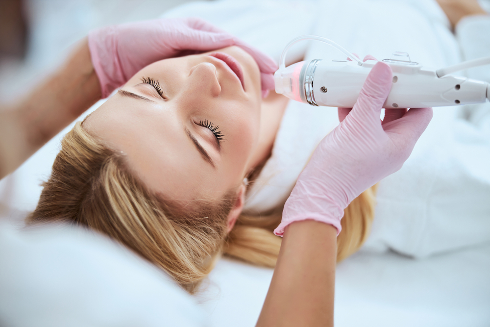 Microneedling in Laguna Beach
