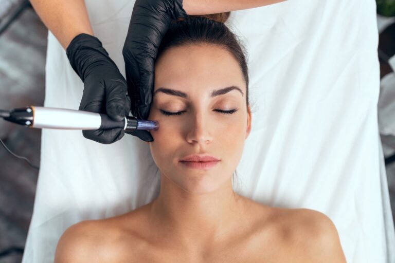 Microneedling in Huntington Beach, CA