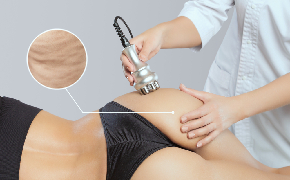 Cavitation in Westminster