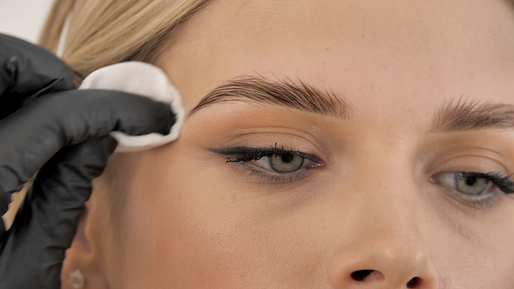 Ultherapy Brows in Irvine