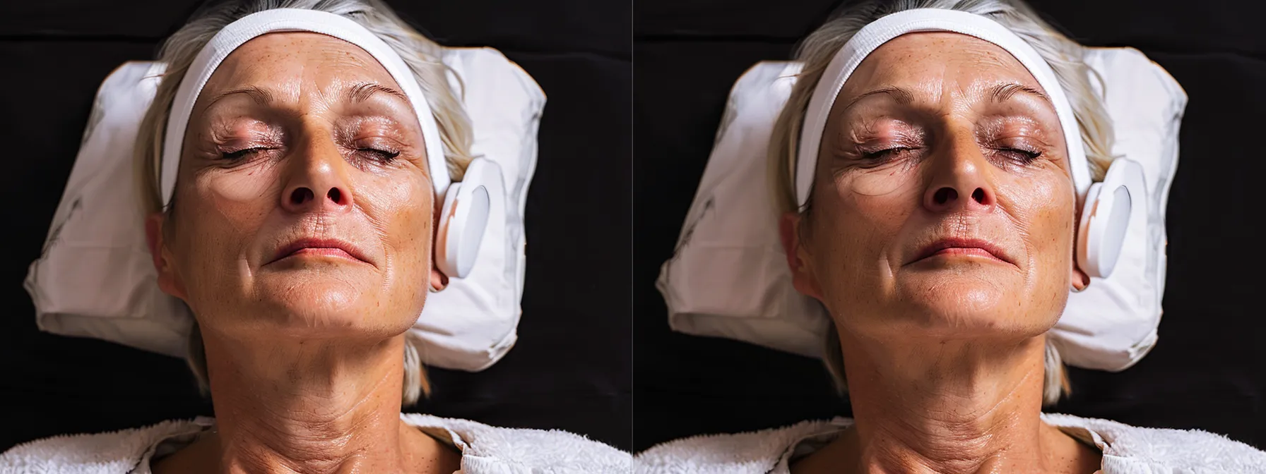 a radiant woman receiving a non-surgical facelift treatment, her skin glowing with a youthful appearance.
