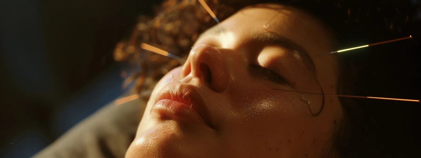 a serene woman with relaxed facial muscles receiving acupuncture on specific points, her skin glowing with rejuvenation.
